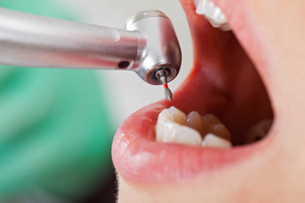Best Pediatric Emergency Dentist in Johnsonburg, PA